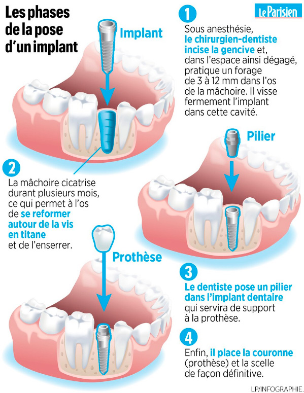 Implantologie 2