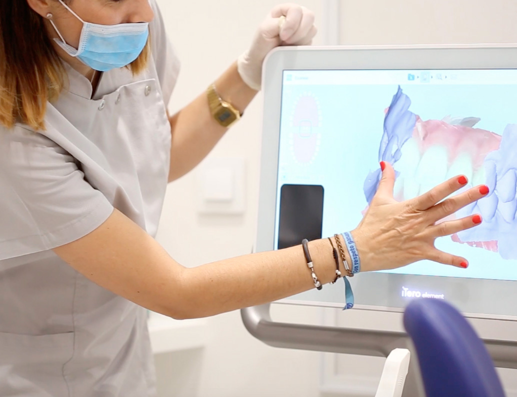 scanner optique dentiste